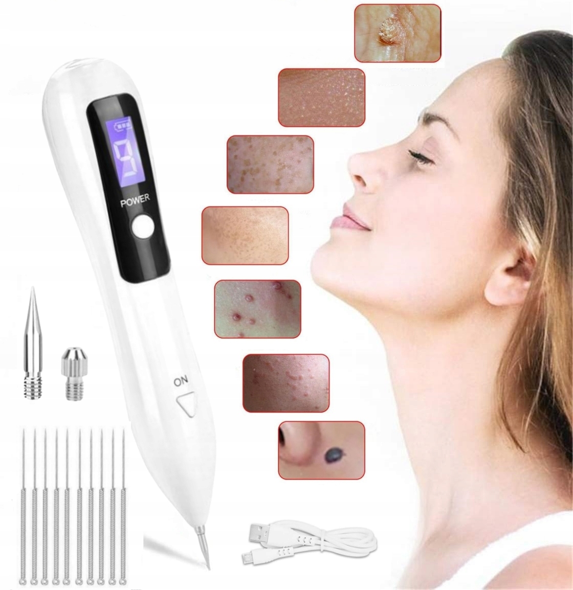 Laserové Pero Pro Odstranění Známek Plazmou, Na Bradavice A Pihy