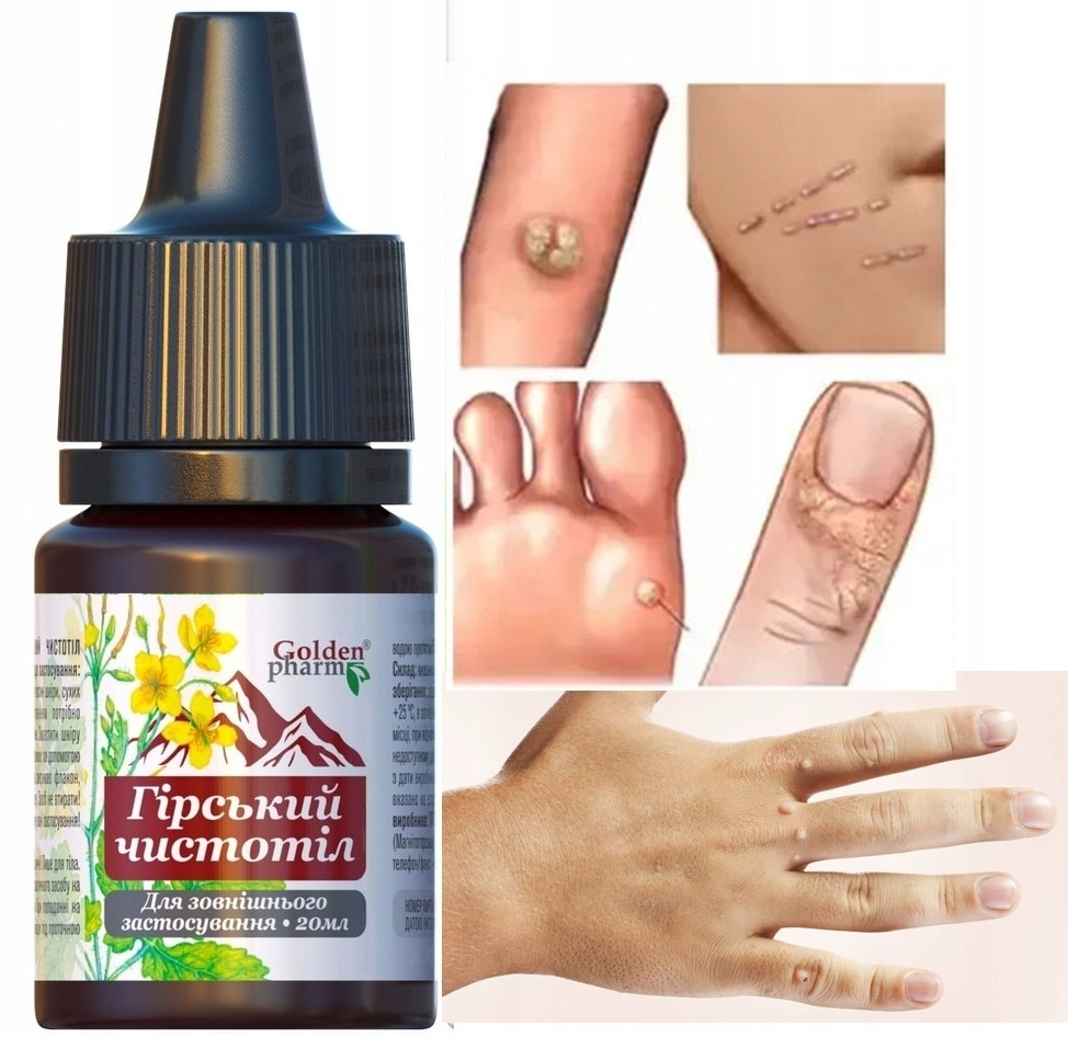 Glistnik Górský Vlaštovičníkové byliny Extrakt Кurzajky Bradavice silný 20 ml tekutina