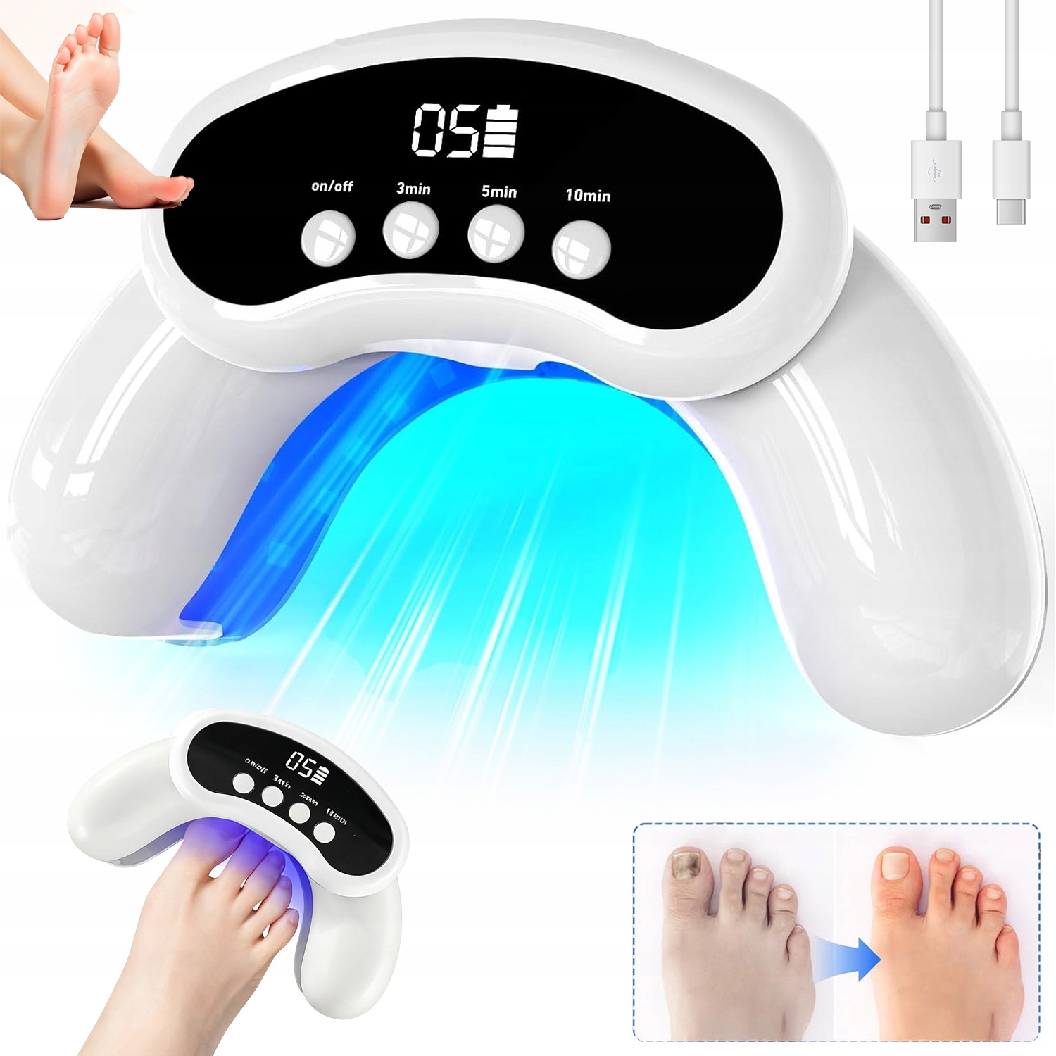 Laserové Zařízení Na Nehty Led Léčba Mykózy Bezbolestné 2000 mAh