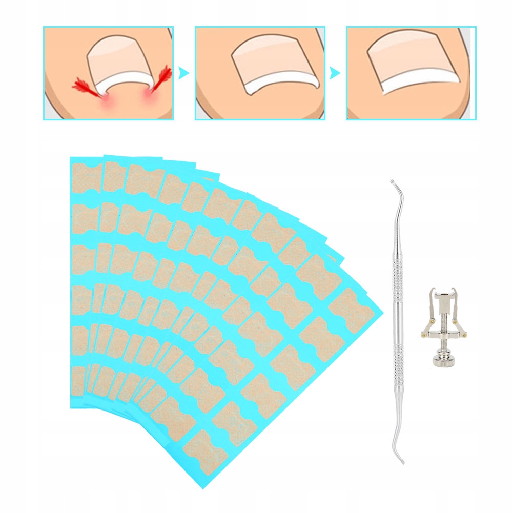 120X PASKI ŁATKI NA WRASTAJĄCE PAZNOKCIE PLASTRY Rodzaj sprężynka