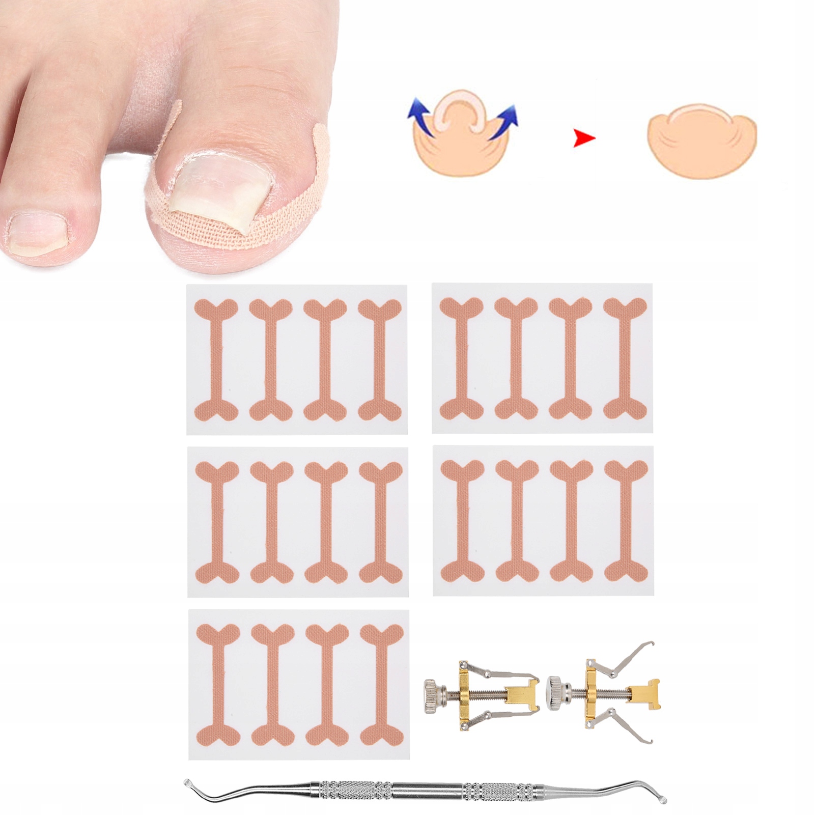 ZESTAW KOREKCYJNY KLAMRA NA WRASTAJĄCA TAŚMA KOREKCYJNA DO PAZNOKCI U STÓP