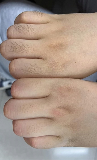 Depilator kryształowy bezpolesny złuszczasz włosów Marka inna marka