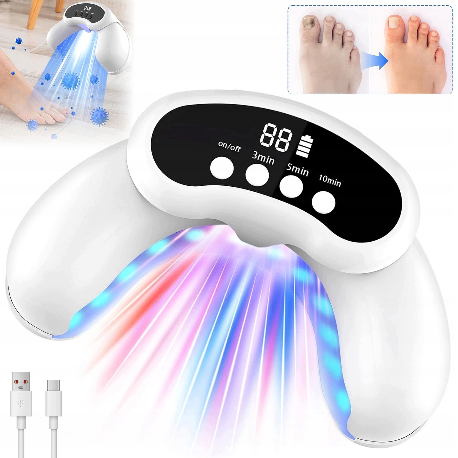 Léčba Mykózy Nehtů Doma Pomocí Laseru 905 Nm A Modrého Led 470 Nm
