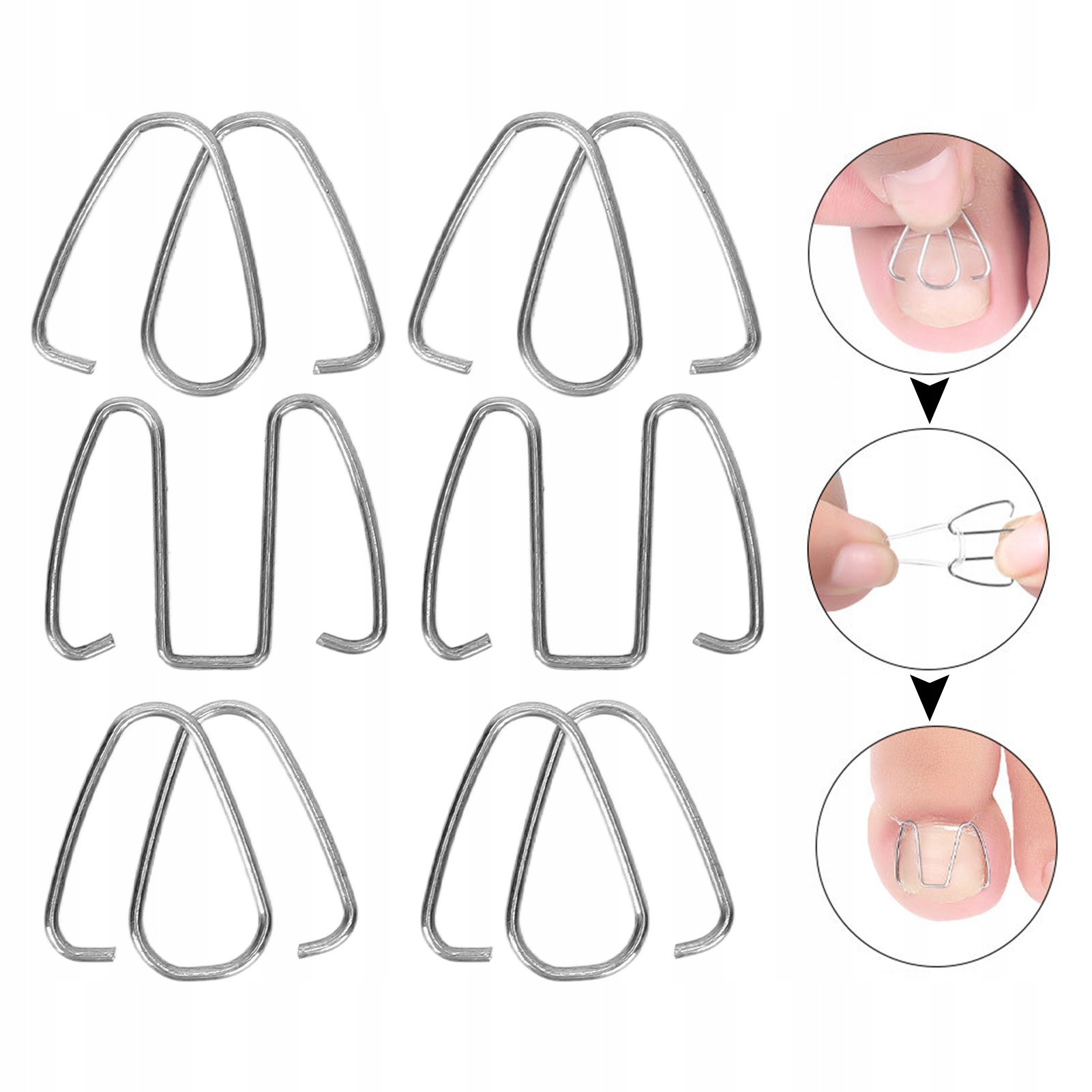 KLAMRY NA WRASTAJĄCE PAZNOKCIE KOREKTOR Wyrób medyczny nie