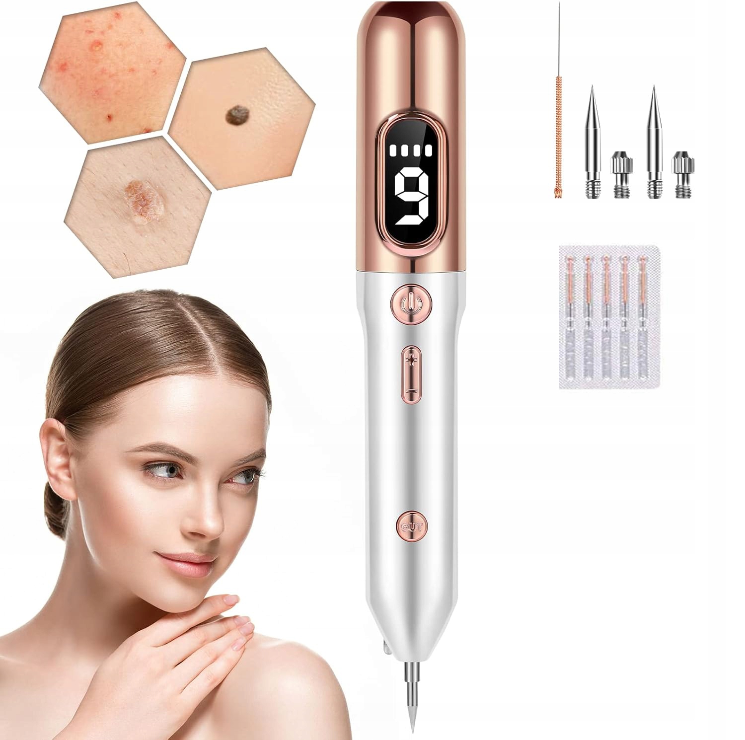 Bezbolestný plazmový laser odstraňuje bradavice bez poškození pokožky Bezpečný