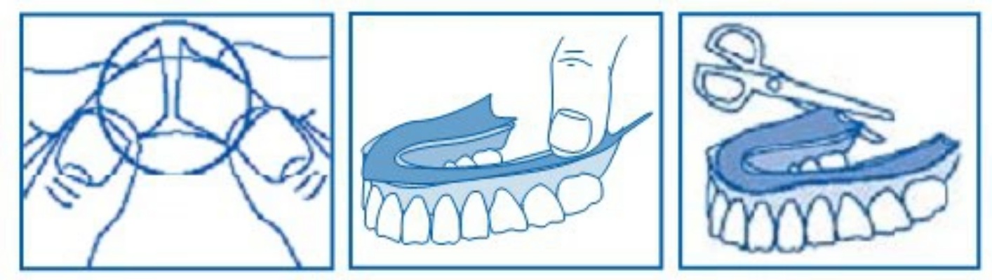 PODKŁADKI POD PROTEZĘ FITTYDENT 15 SZT WODOODPORNE Marka Fittydent