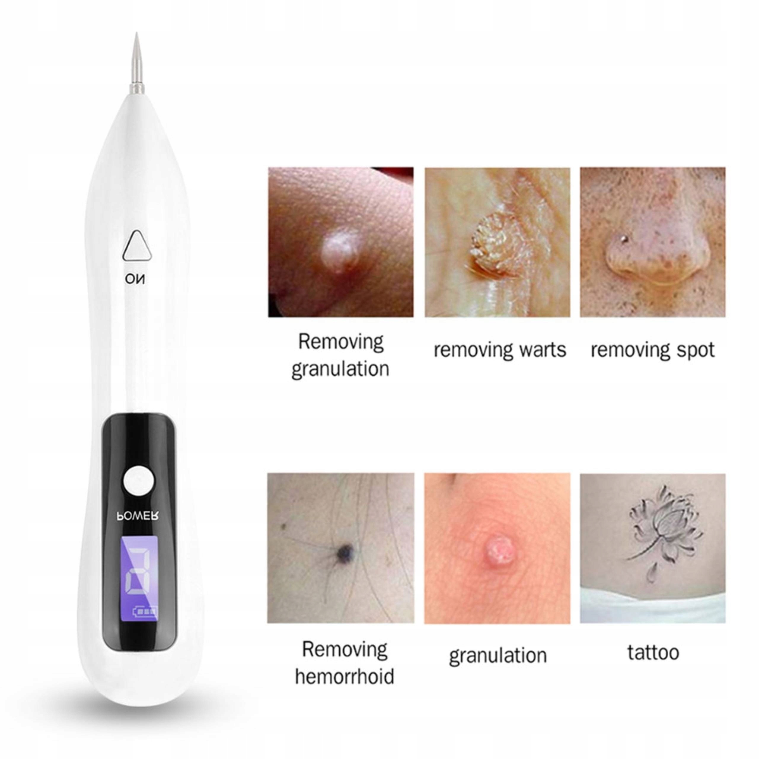 DŁUGOPIS PLAZMOWY DO USUWANIA ZNAMION I BRODAWEK Producent Inna