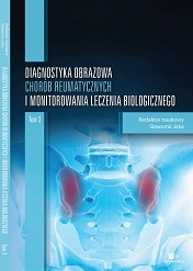 

Diagnostyka Obrazowa Chorób Reumatycznych Tom III