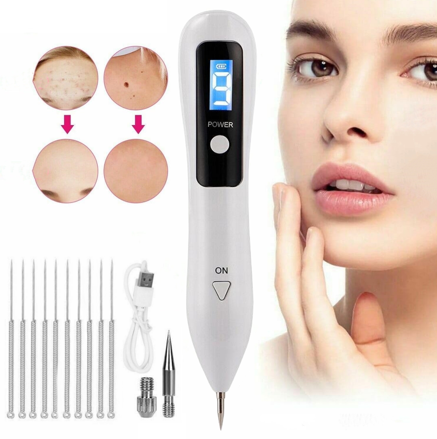 Laser Pen Plazma – odstranění tetování, jizev, bradavic, 9 nastavitelných úrovní