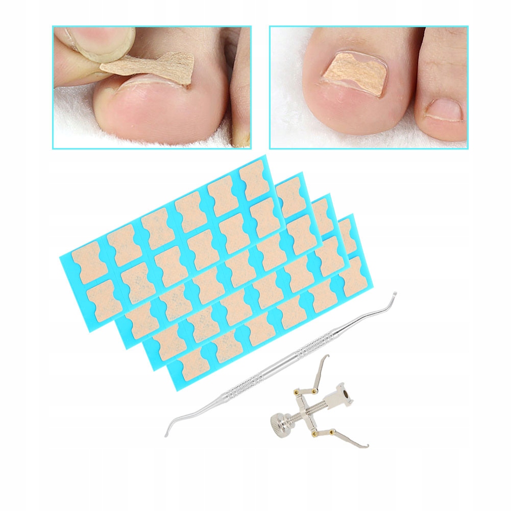 PASKI ŁATKI NA WRASTAJĄCE PAZNOKCIE PLASTRY 48SZT. Waga produktu z opakowaniem jednostkowym 0.04 kg