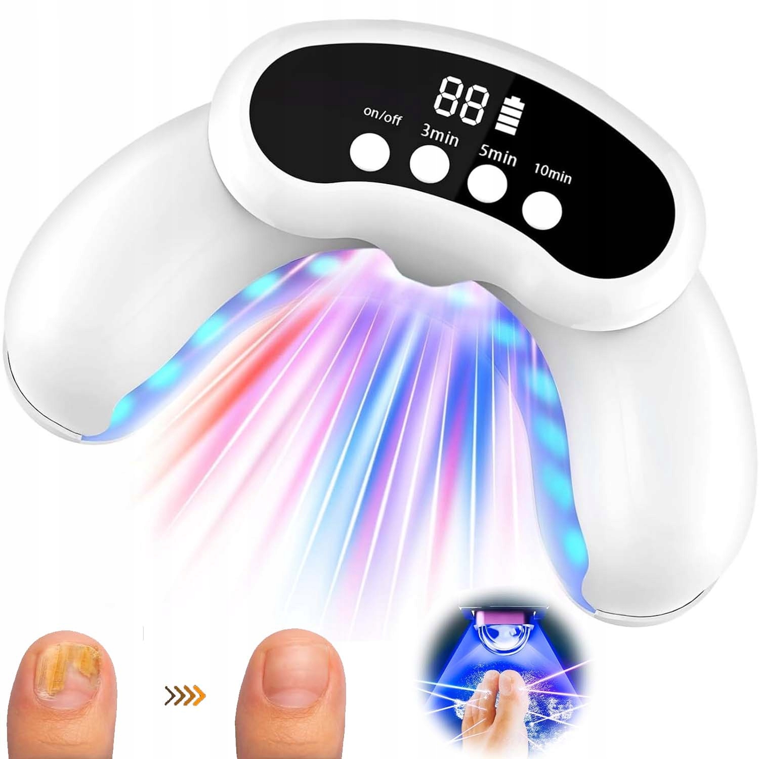 Přenosná Uv Lampa S Laserovým Světlem Na Mykózu Nehtů 905 Nm 470 Nm