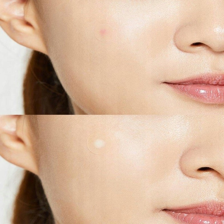 COSRX PLASTRY MASTER PATCH ORIGINAL FIT 24 SZTUKI KOREAŃSKIE KOSMETYKI Typ skóry Problematyczna