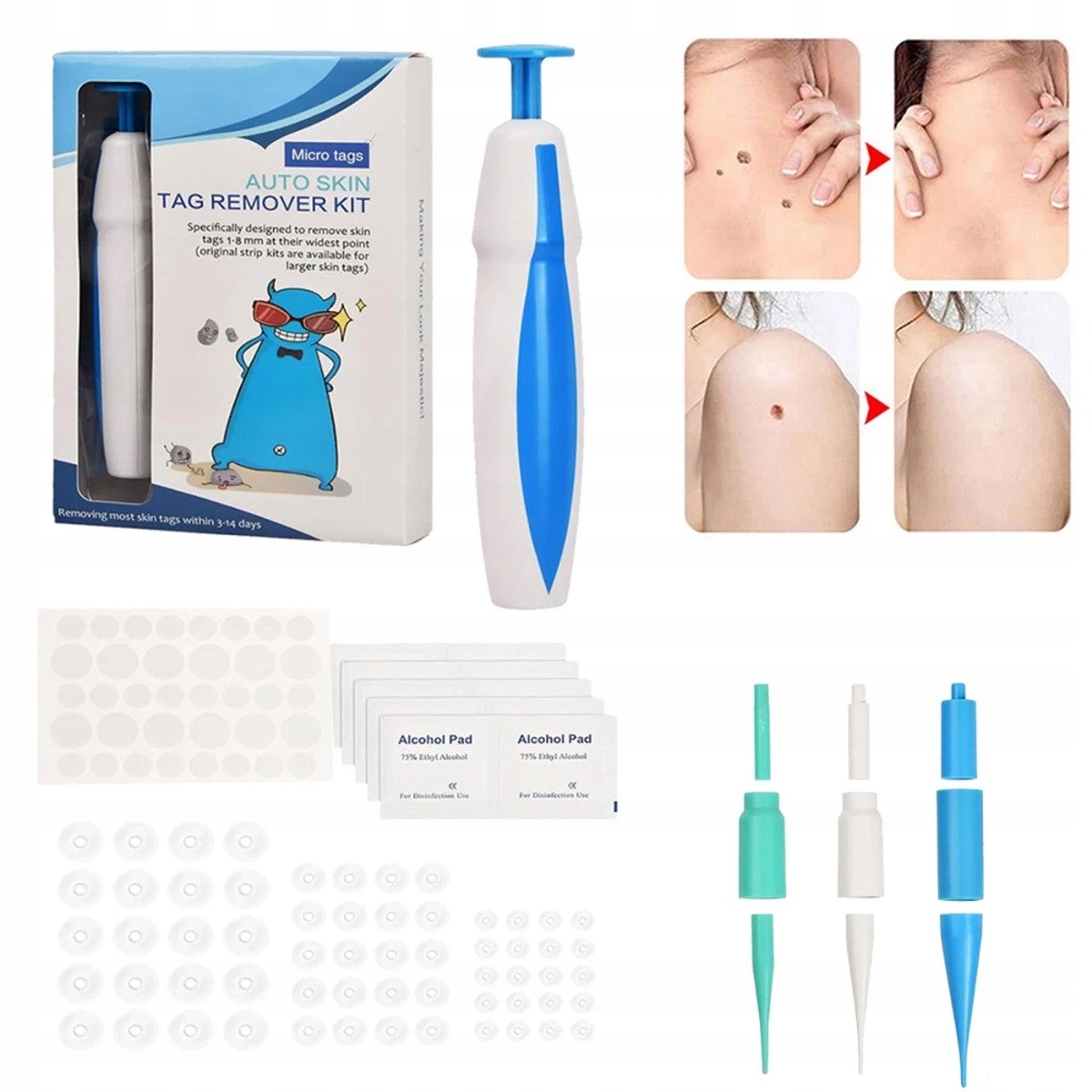 Sada na odstraňování bradavic,Odstraňte kožní výrůstky, otřepy a jemné otisky