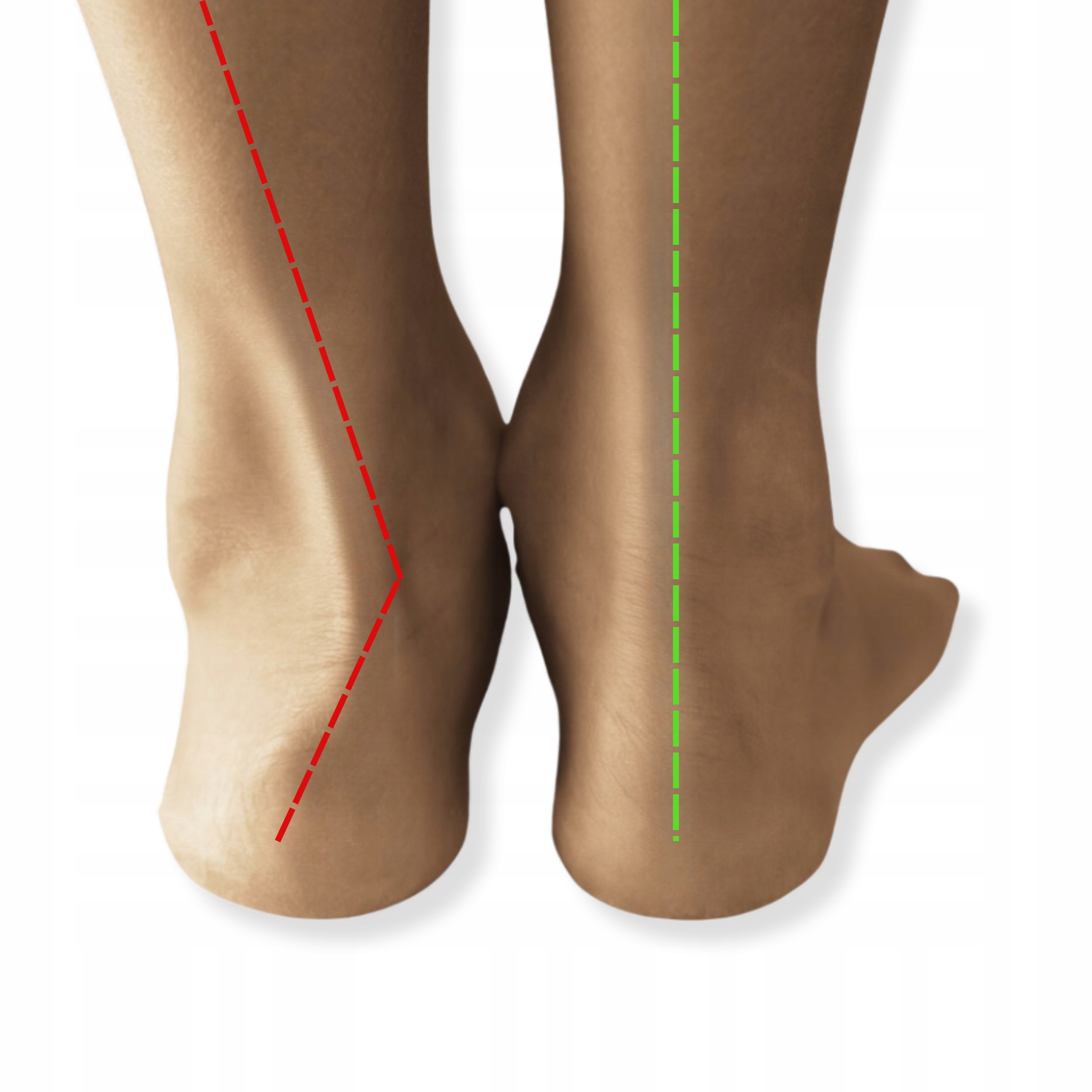 WKŁADKI DO BUTÓW NA KOŚLAWOŚĆ I PŁASKOSTOPIE- SUPINUJĄCE MĘSKIE Rozmiar zakresowy 39-39
