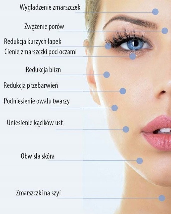 Dr Pen M8-W BEZPRZEWODOWY Dermabrazja Mezoterapia Mikroigłowa 20 Kartdridży EAN (GTIN) 5908252868407
