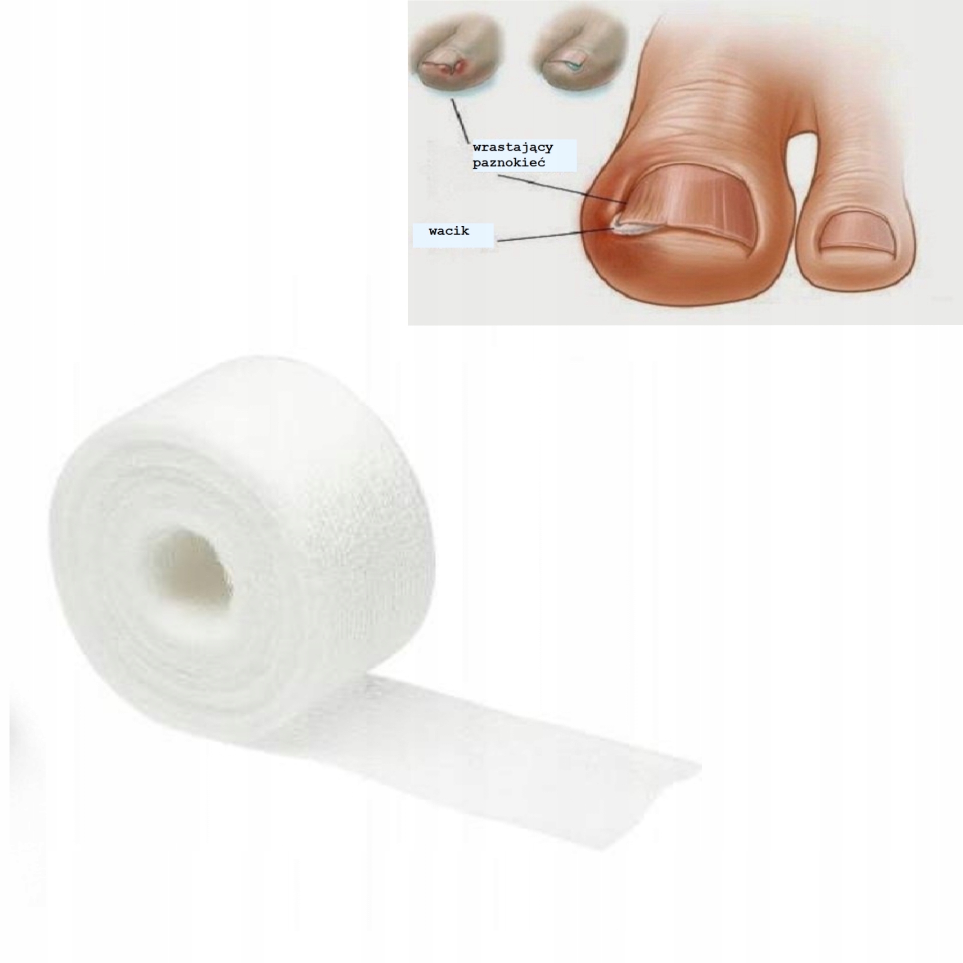 WRASTAJĄCE PAZNOKCIE Cążki Sonda Tamponada zestaw EAN (GTIN) 3000000004685