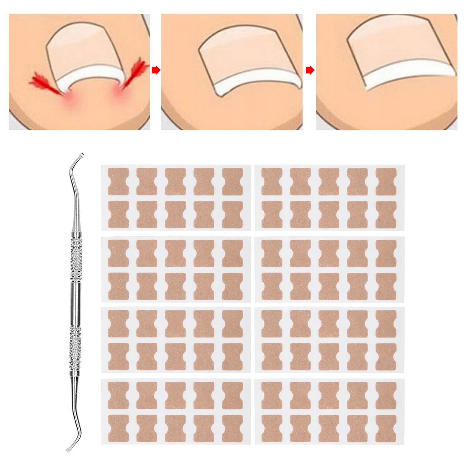 PLASTRY NA WRASTAJĄCE PAZNOKCIE U STÓP Z NARZĘDZIE Marka bez marki