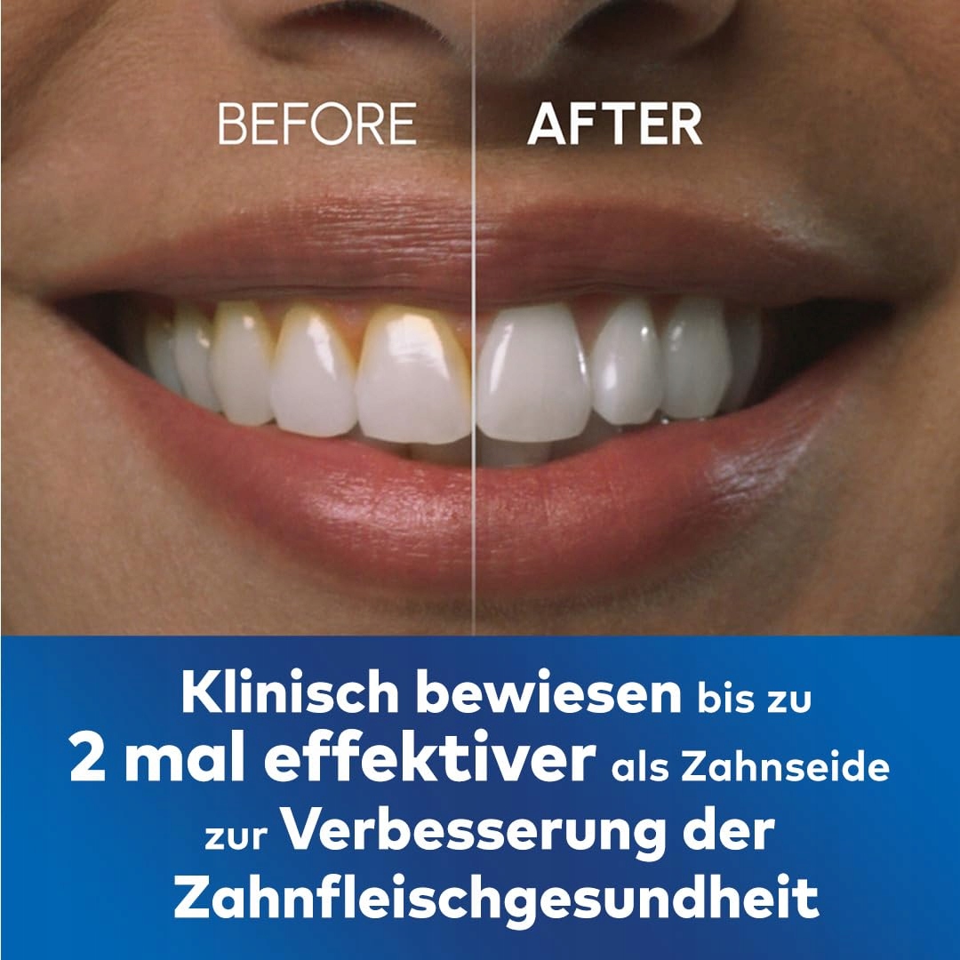 WATERPIK Ultra Profesjonalny Irygator, 7 Końcówek, 10 Ustawień, Czarny — miniatura 5