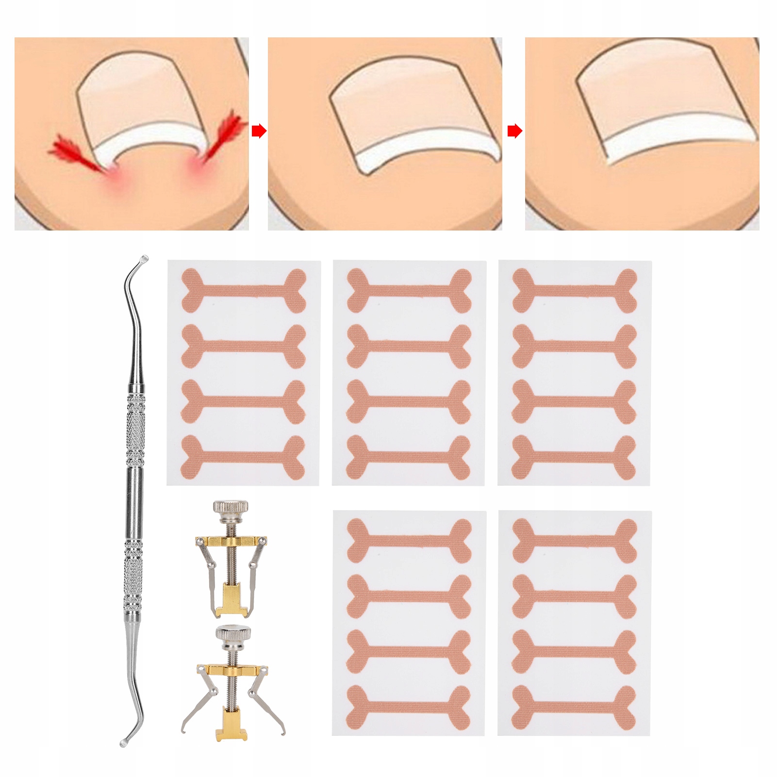 ZESTAW KOREKCYJNY KLAMRA NA WRASTAJĄCA TAŚMA KOREKCYJNA DO PAZNOKCI U STÓP