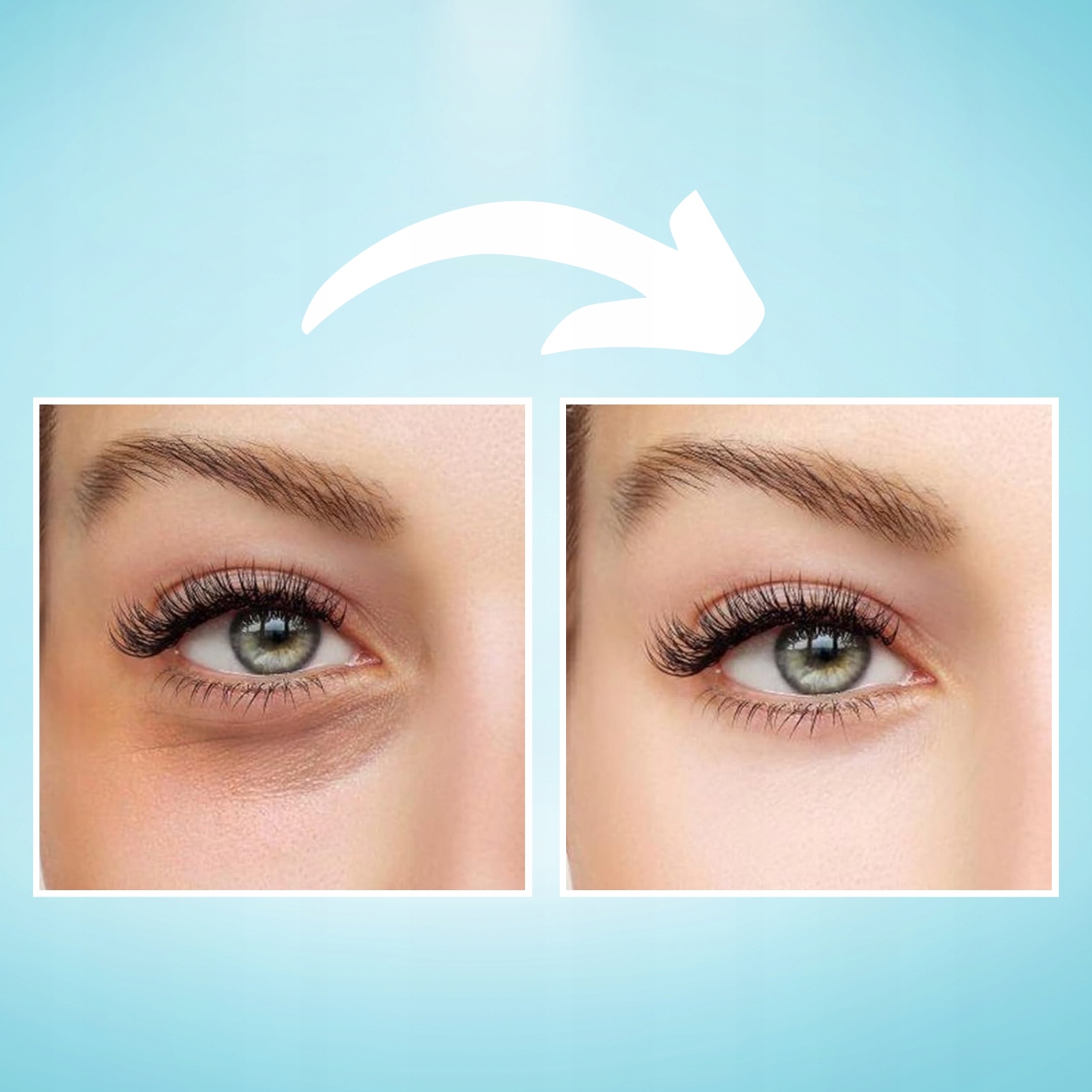 LANBENA MASECZKA POD OCZY PŁATKI ŻELOWE HYDROŻELOWE KWAS HIALURONOWY 60 SZT Typ skóry Do wszystkich typów skóry