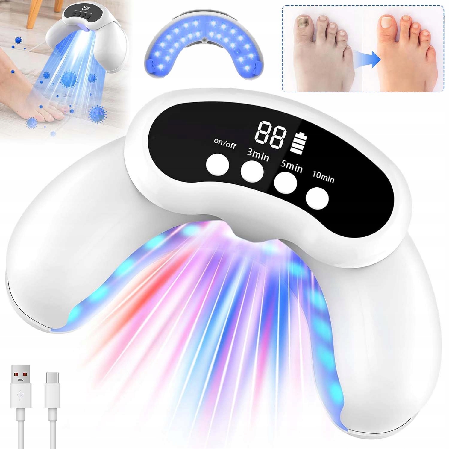 Laserové Zařízení Pro Léčbu Mykózy Nehtů, Bezbolestné, Účinné