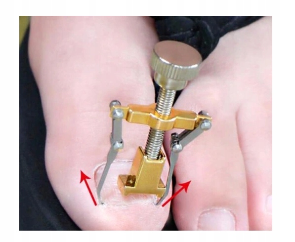 KLAMRA DO WRASTAJĄCYCH PAZNOKCI CĄŻKI R 8 Marka Marti