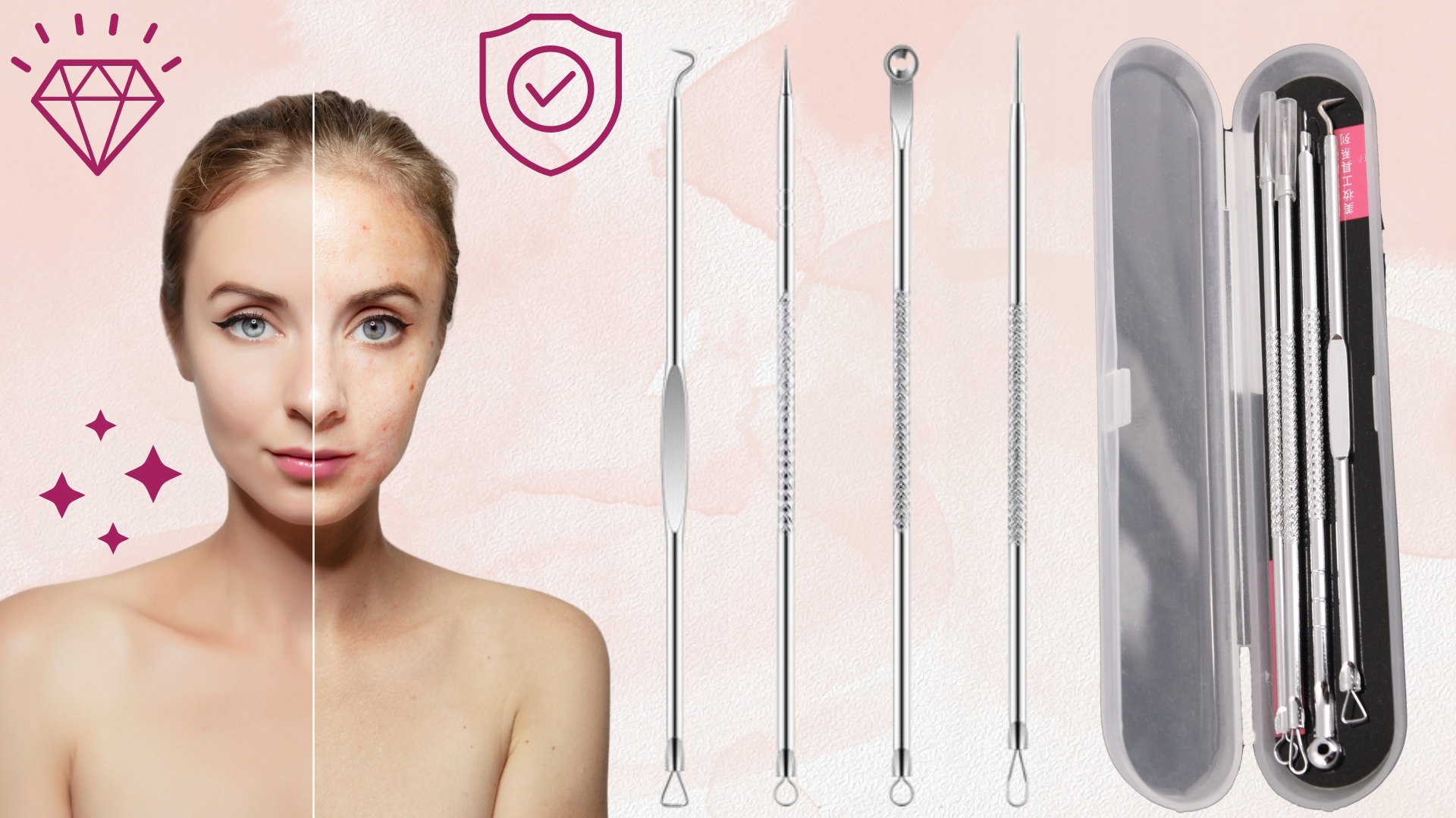 ŁYŻECZKI PĘTELKOWE 4 UNNY DO USUWANIA ZASKÓRNIKÓW Stan opakowania oryginalne