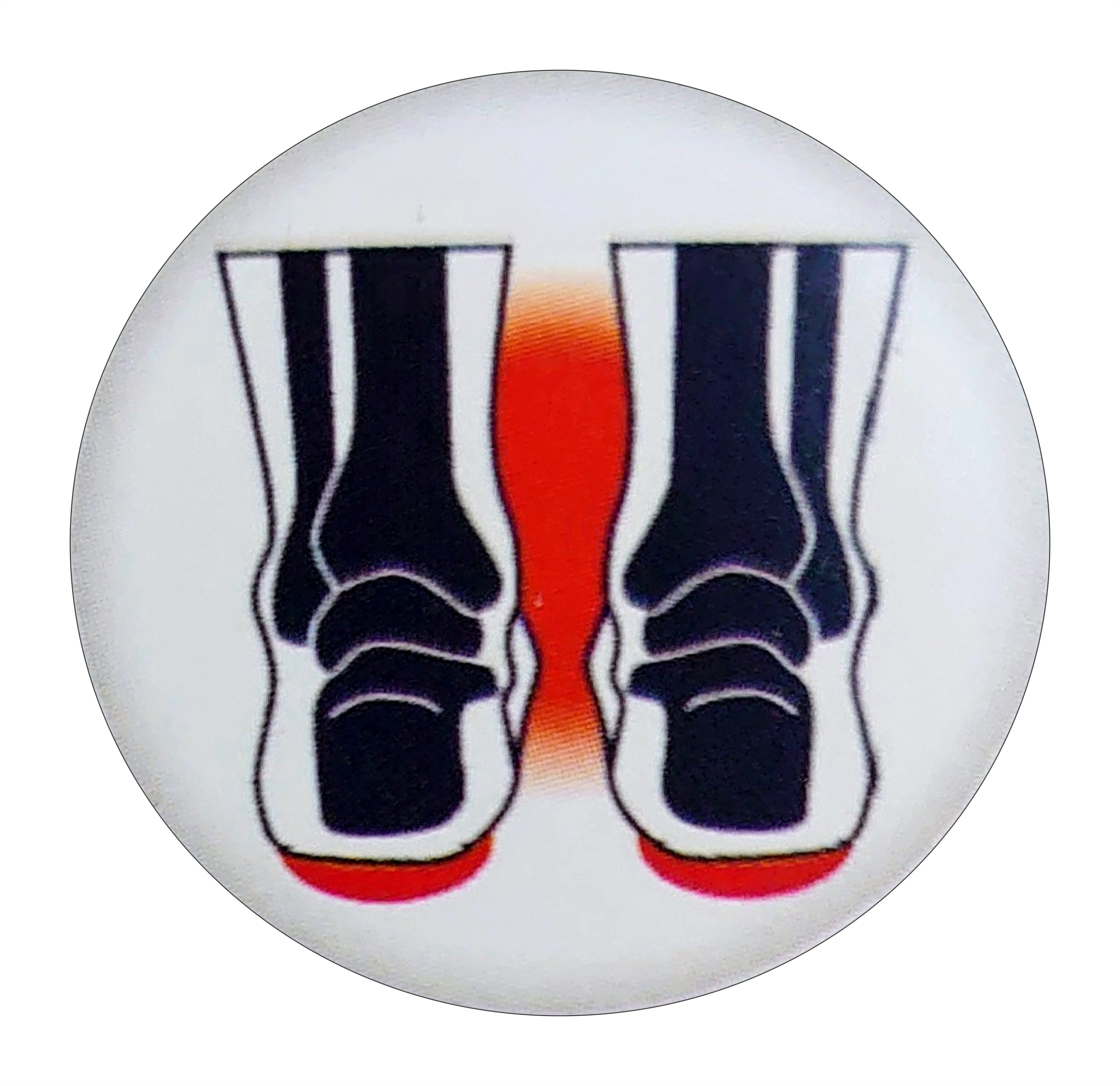 WKŁADKI ORTOPEDYCZNE NA OSTROGI PIĘTOWE KOMFORTOWE Marka PodOrtic