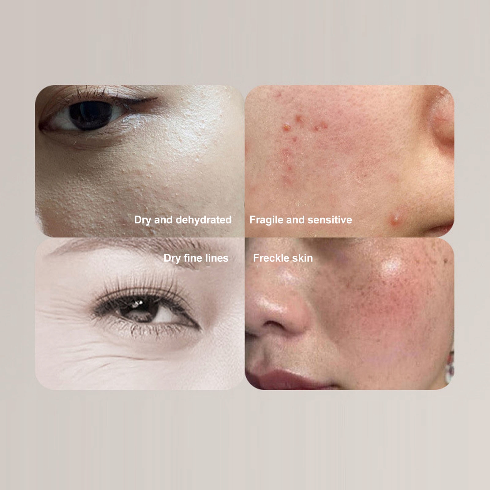 KOSMETYCZNY ANALIZATOR SKÓRY - SKIN ANALIZER PRO Marka bez marki