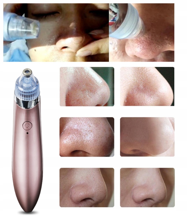 ODKURZACZ WĄGRÓW DO CZYSZCZENIA PORÓW Kod producenta VM-2900