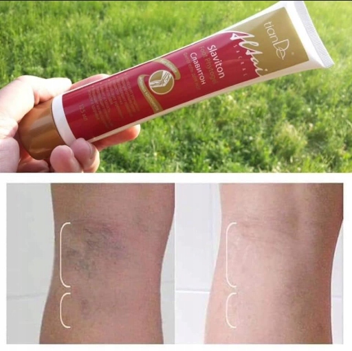 tianDe Żel Slaviton Popękane Naczynka Żylaki, Ciężkie Nogi