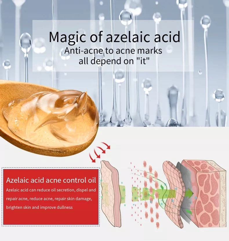 Azelaic Acid Anti-Acne Gel Acne Size Sản phẩm có kích thước đầy đủ