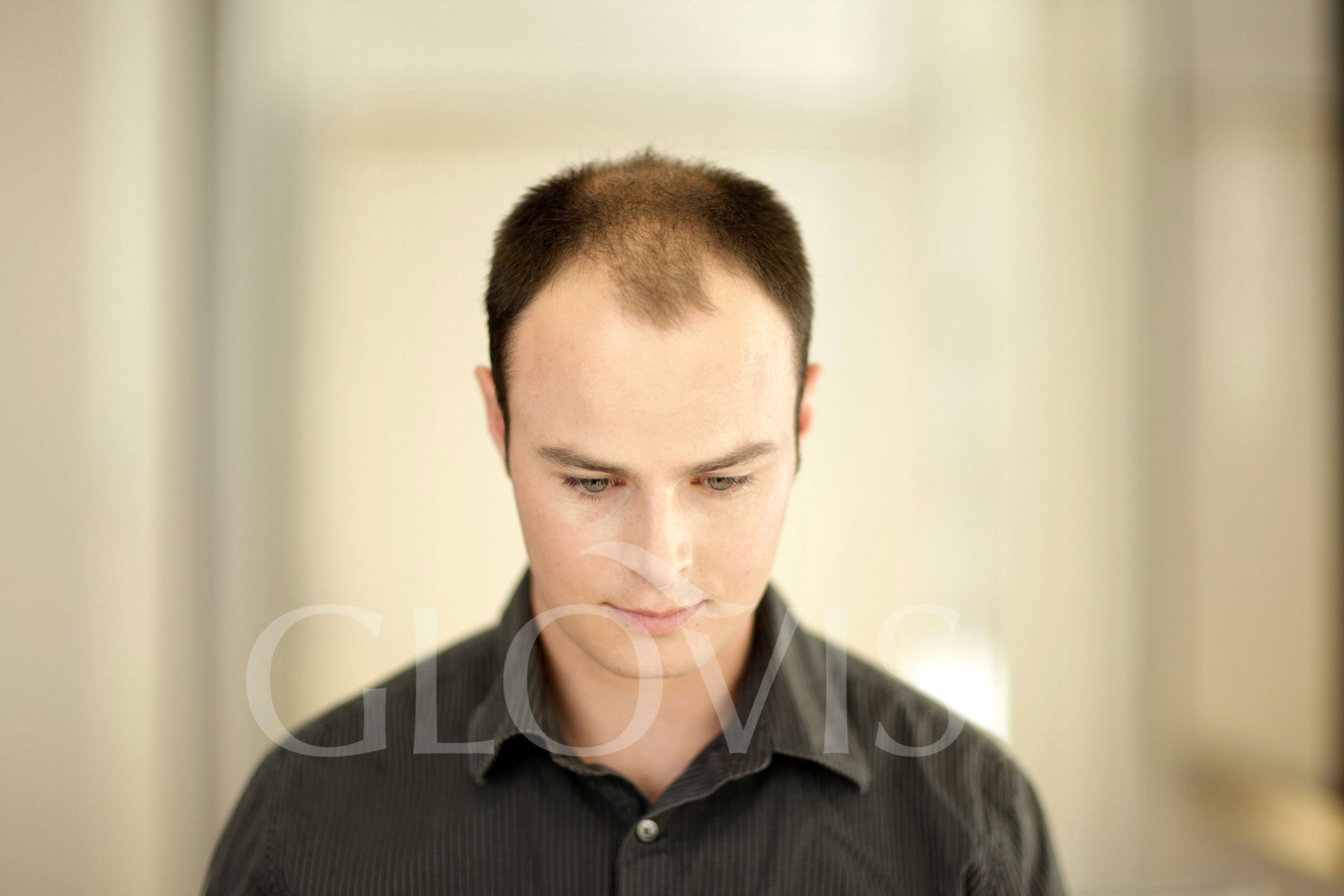 GLOVIS Thickener 400ml Mikrowłókna w Sprayu JAKOŚĆ Marka Glovis