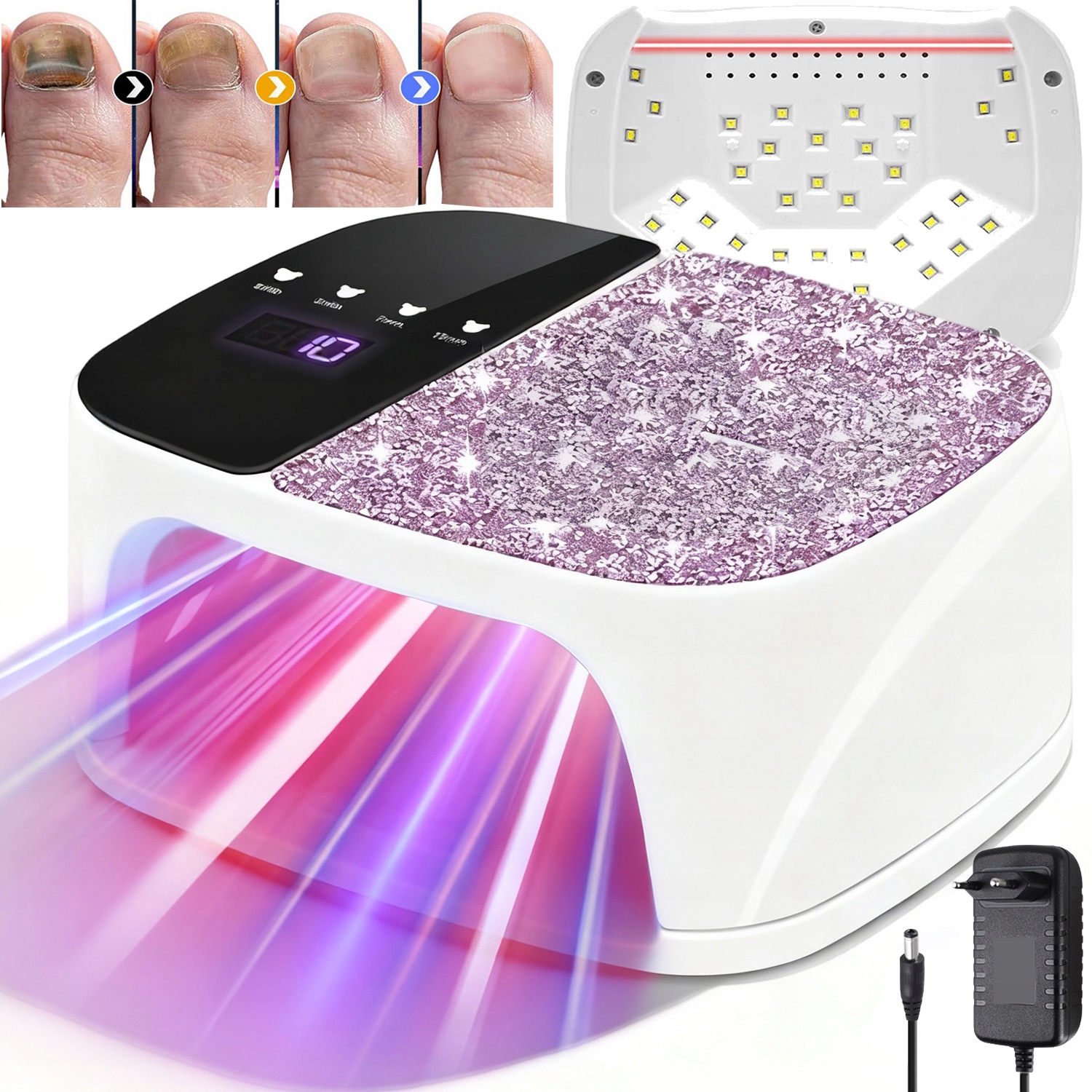 Laserové Zařízení Pro Léčbu Mykózy Nehtů, Bezbolestné, Účinné
