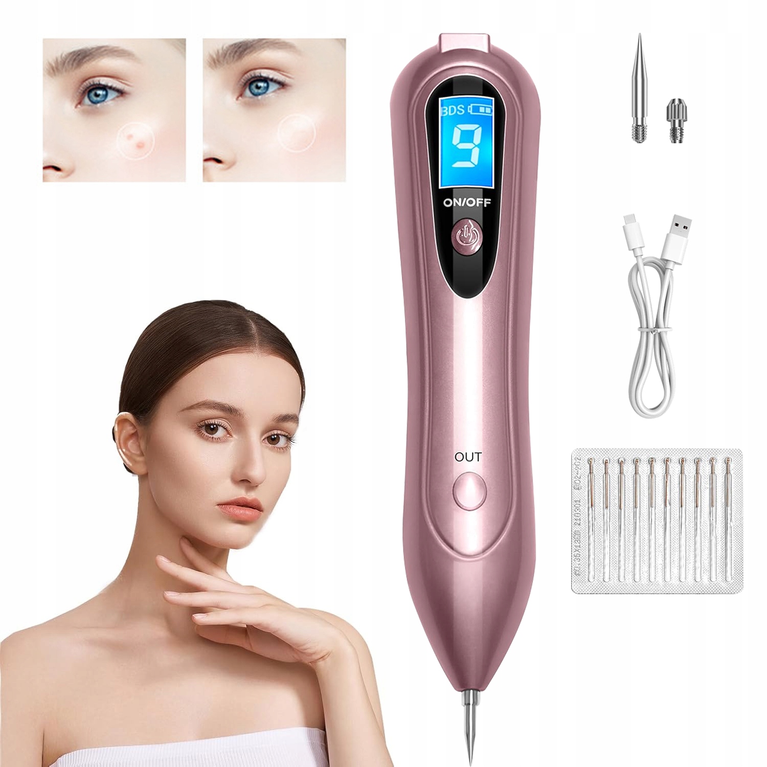 Propiska Pero Plazmový Laser Pen Zařízení Pro Odstraňování Bradavic