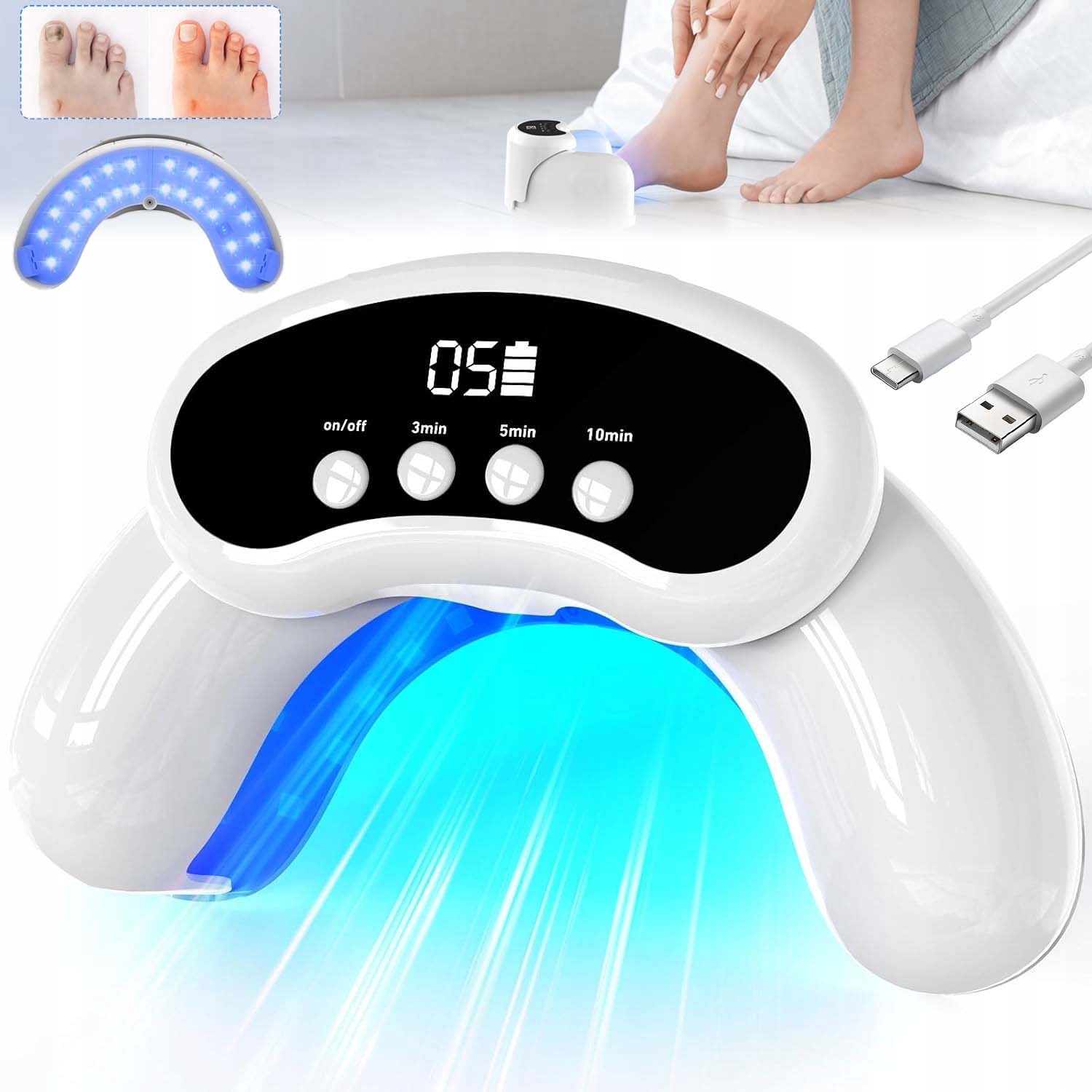 Laserové Zařízení Na Léčbu Nehtové Mykózy S 3 Nastaveními Času