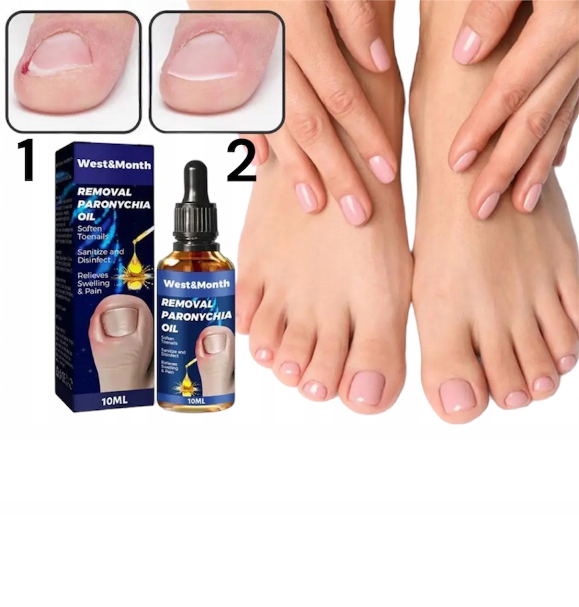PŁYN NA WRASTAJĄCE PAZNOKCIE NA BÓL PAZNOKCIA Rodzaj inny