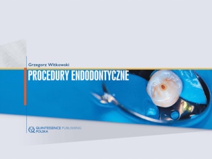 

Procedury Endodontyczne