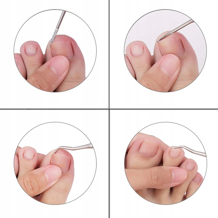 ZESTAW DO WRASTAJĄCYCH PAZNOKCI SONDA PODOLOGICZNA Kod producenta S19597