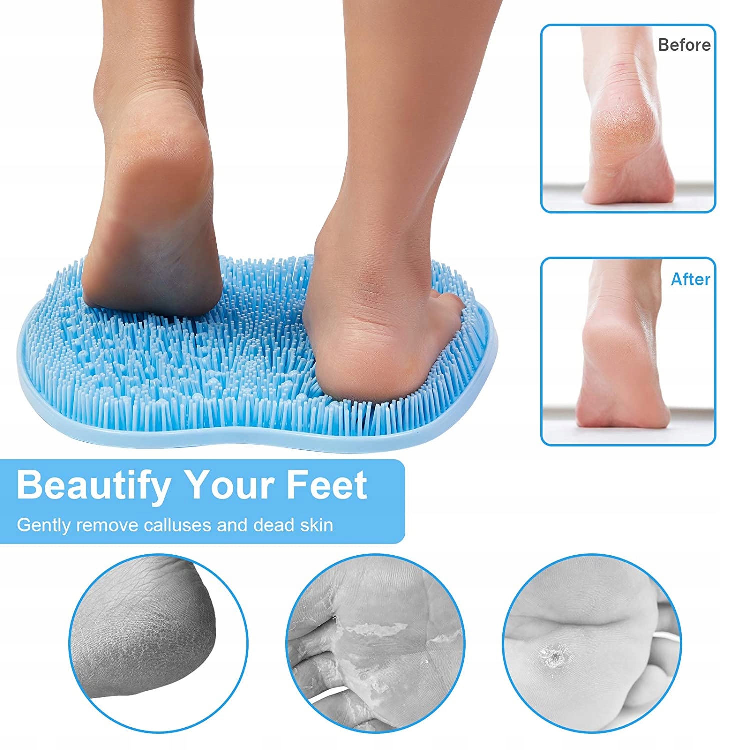 MASAŻER DO CIAŁA SZCZOTKA DO MYCIA PLECÓW NÓG STÓP Typ skóry Do wszystkich typów skóry