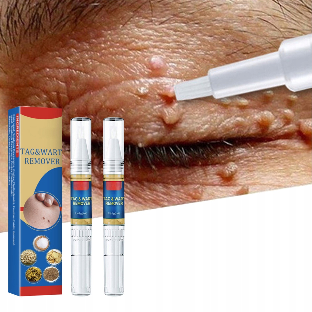 2SZT ORYGINALNE PIÓRO DO USUWANIA BRODAWEK