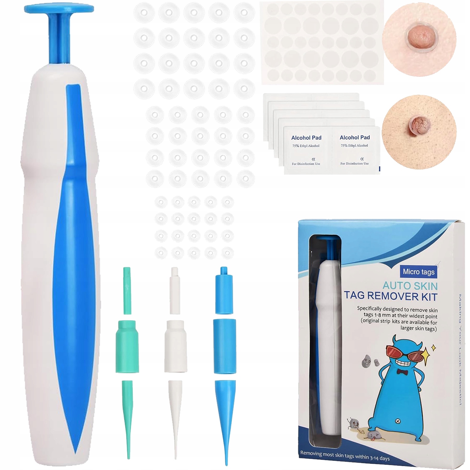 Sada na odstraňování kožních výrůstků Odstraňte kožní výrůstky