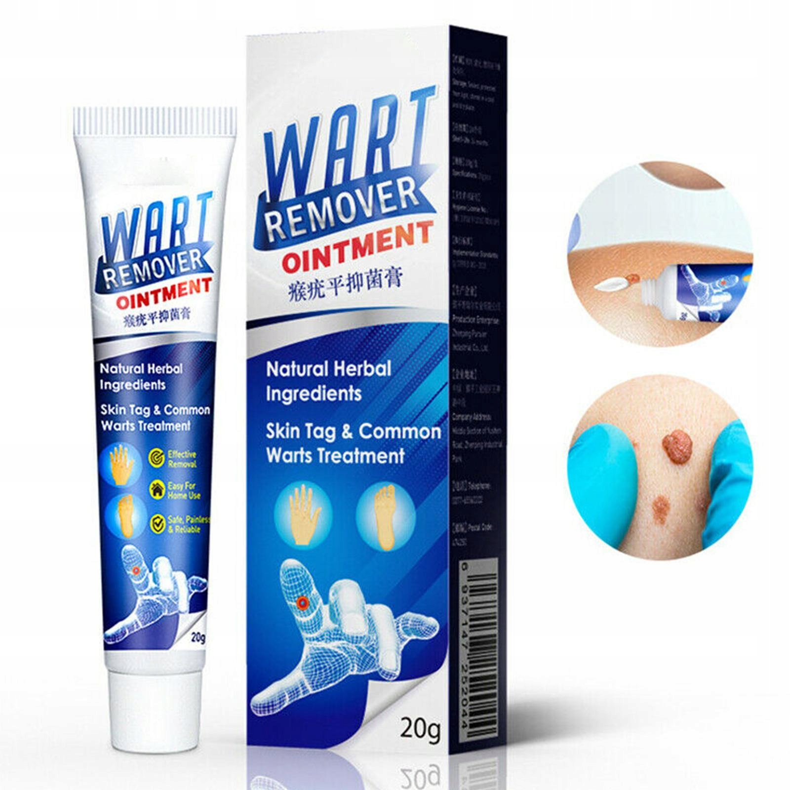 Wart-Removal-Ointment-Wart-Treatment-Cream-Wielkosc-Miniaturka