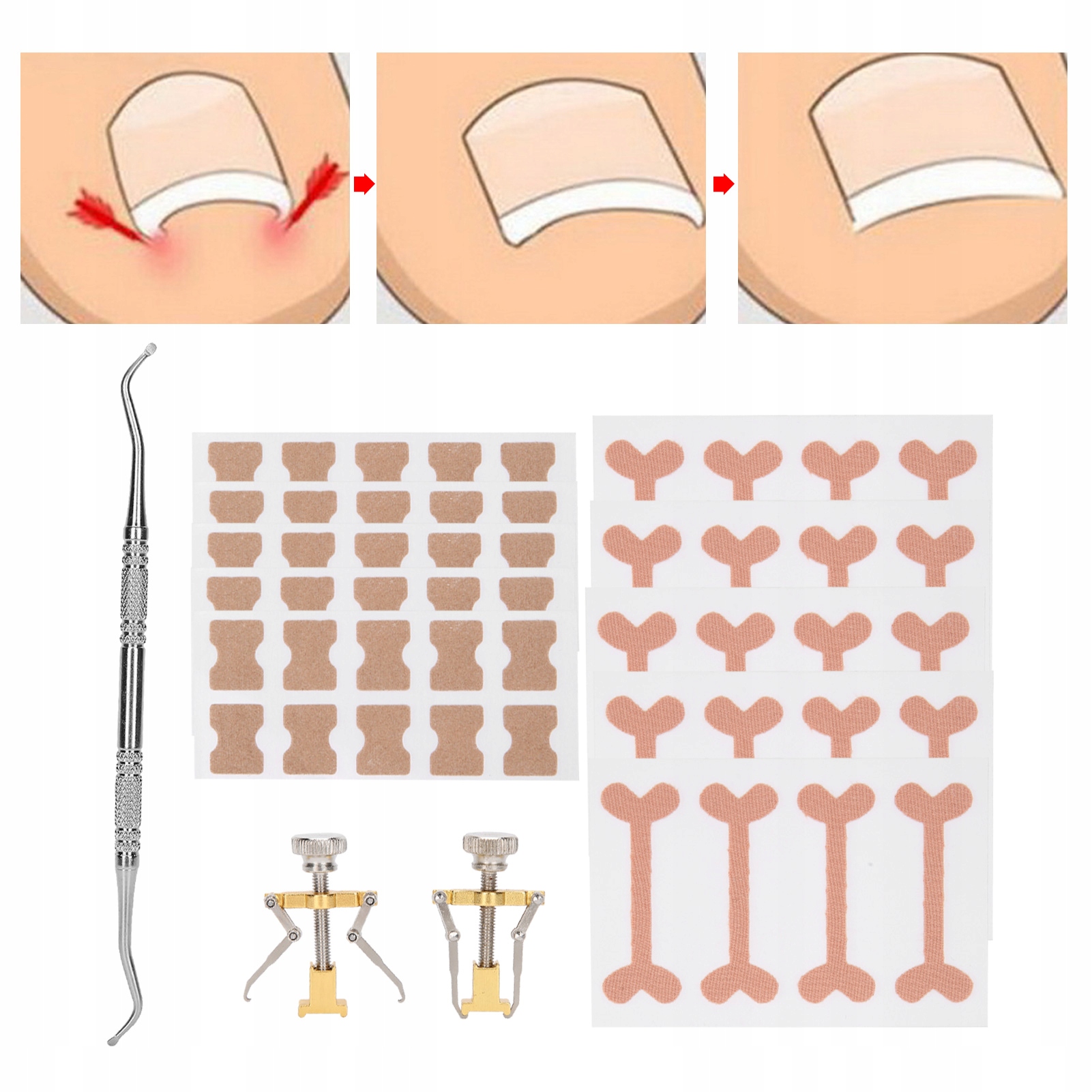 PASKI ŁATKI NA WRASTAJĄCE PAZNOKCIE PLASTRY 13S Kod producenta 6977389883644