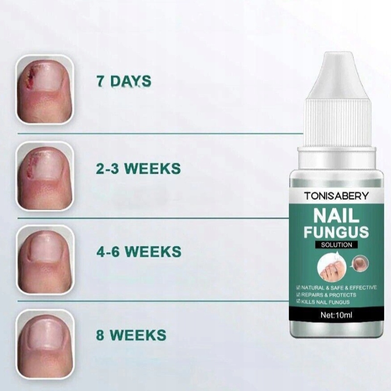 Grzybica paznokci Silny Płyn Do Naprawy Paznokci Marka Oneofthose