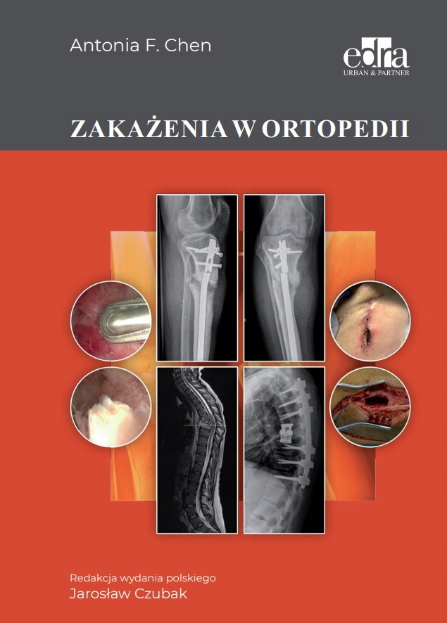 

Zakażenia W Ortopedii. Chen