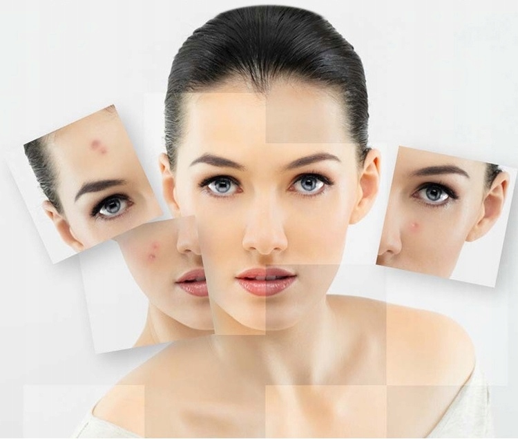 LASER PEN PLAZMA USUWANIE TATUAŻU BLIZN BRODAWEK Model Plazma Pen