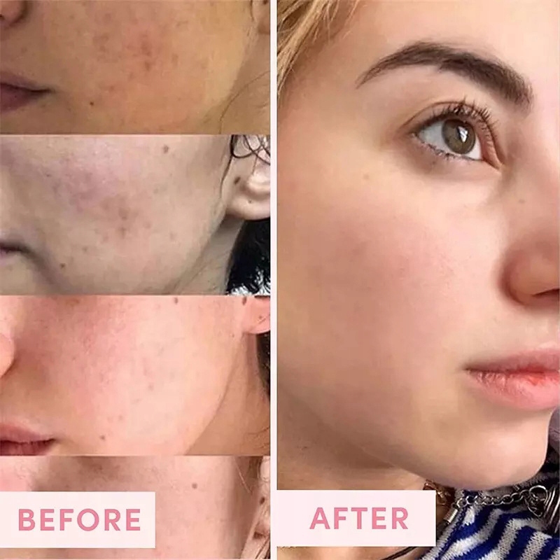 PAULA'S CHOICE 2% BHA Liquid EXFOLIANT 118 ml kwas Marka bez marki