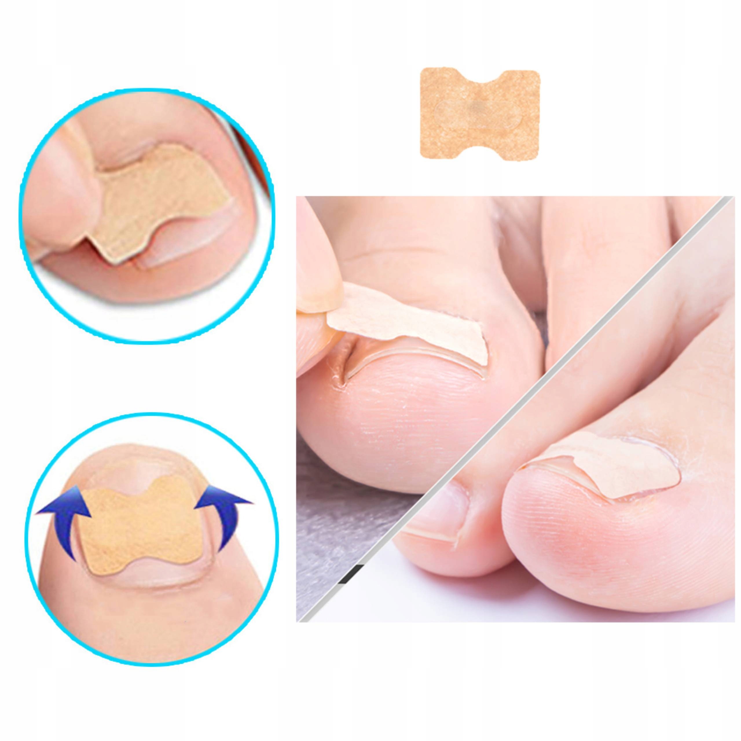 120 SZT PASKI PLASTRY ŁATKI NA WRASTAJĄCE PAZNOKCIE Kod producenta 08012