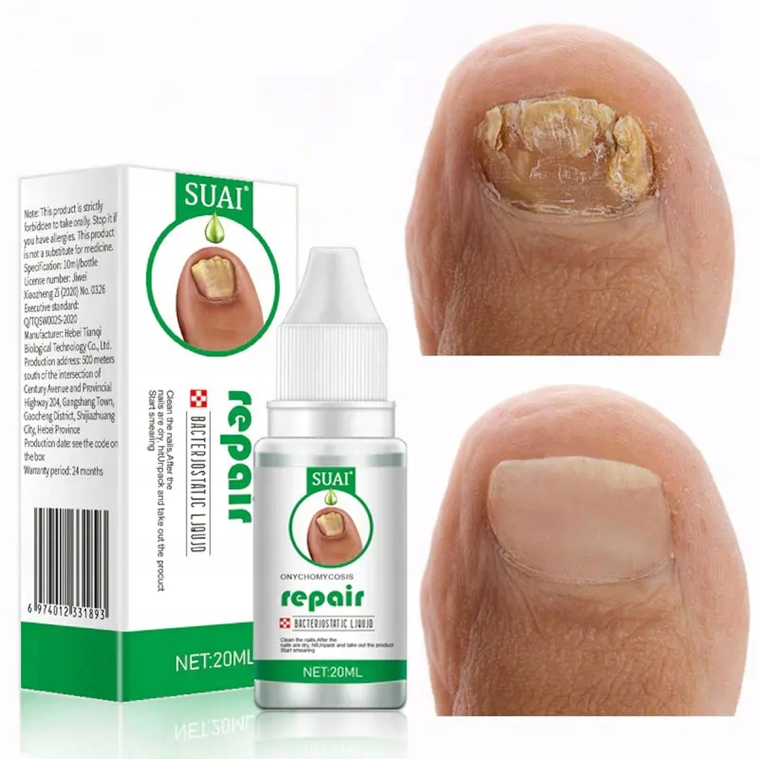 Лечение ногтей купить. Nail Repair Nail treatment onychomycosis treatment net: 10g. Средство от грибка ногтей. Гель от грибка ногтей.